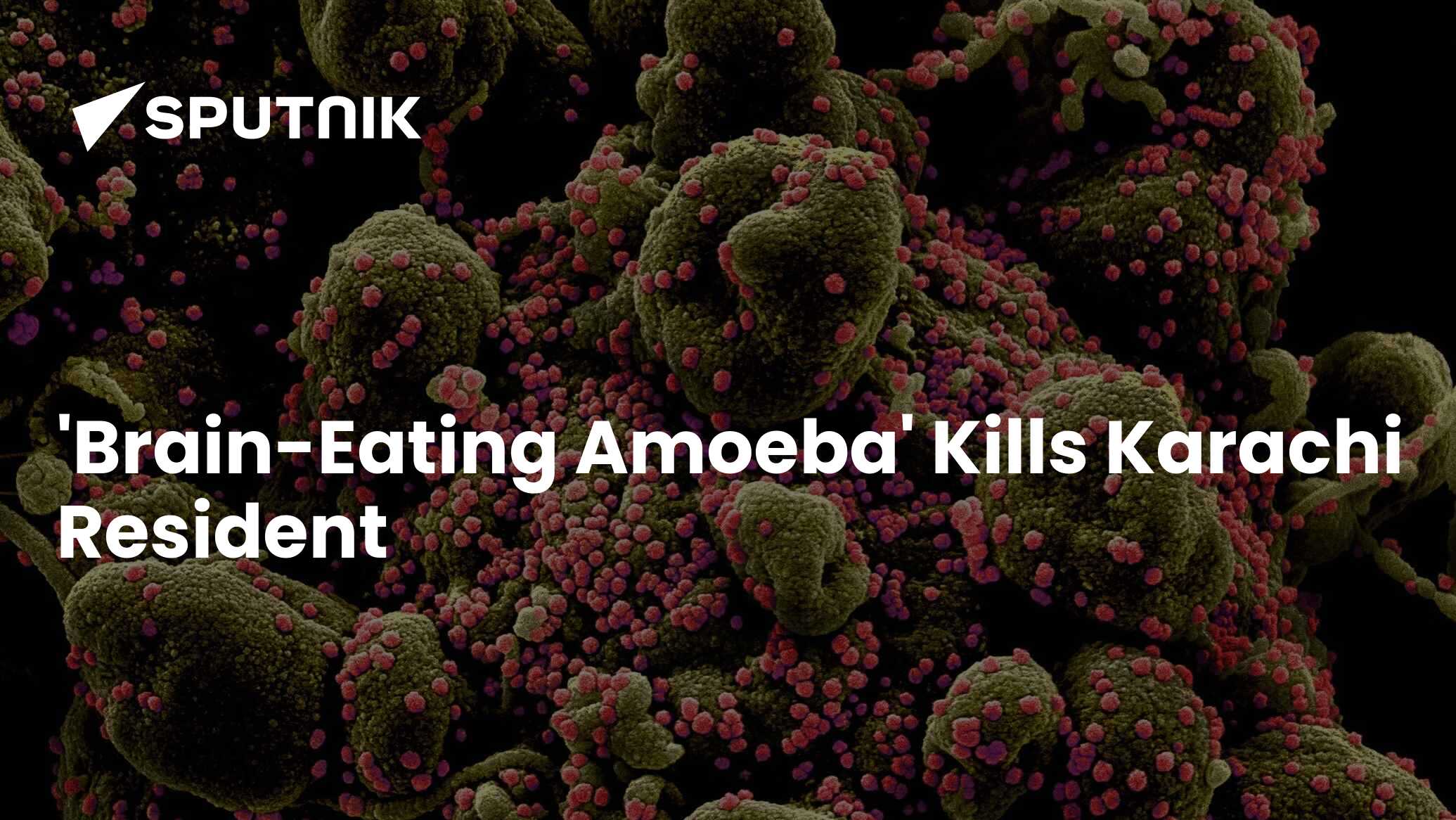 'BrainEating Amoeba' Kills Karachi Resident