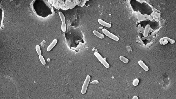 This scanning electron microscopic (SEM) image depicts a number of Gram-negative, Pseudomonas aeruginosa, rod-shaped bacteria. - Sputnik India