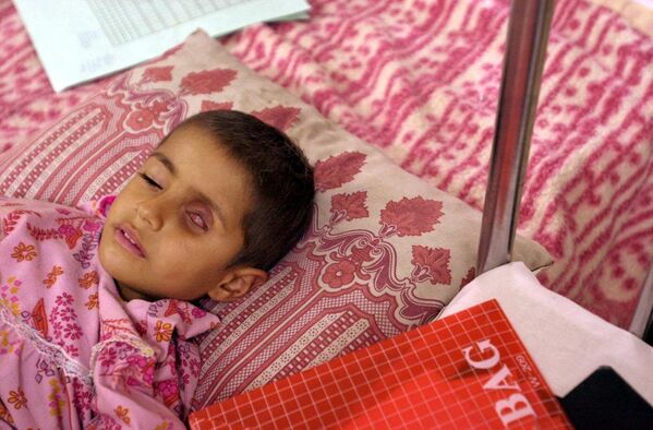 Четырехлетняя Алла Салим, страдающая от опухоли в глазу, вызванной последствиями бомбардировок снарядами с обедненным ураном во время войны в Персидском заливе, в детской больнице Газван в городе Басра на юге Ирака - Sputnik India