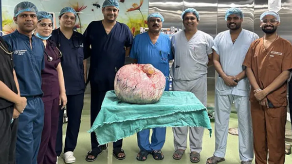 15 kg tumour  - Sputnik भारत