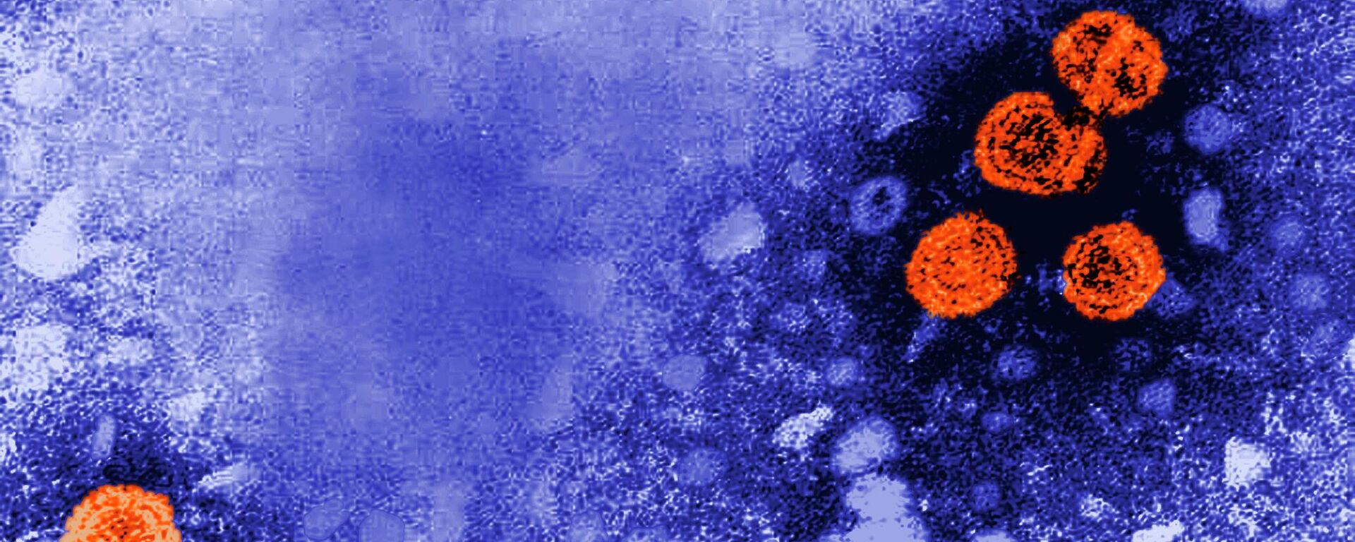 This 1981 electron microscope image made available by the U.S. Centers for Disease Control and Prevention shows hepatitis B virus particles, indicated in orange. - Sputnik India, 1920, 26.11.2023