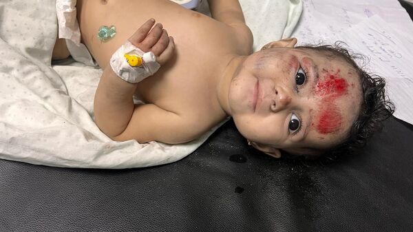 An injured child in Al Shifaa hospital, Gaza - Sputnik भारत