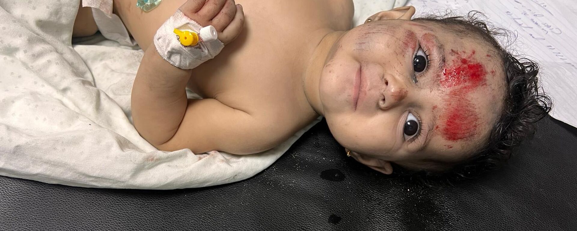 An injured child in Al Shifaa hospital, Gaza - Sputnik भारत, 1920, 28.10.2023