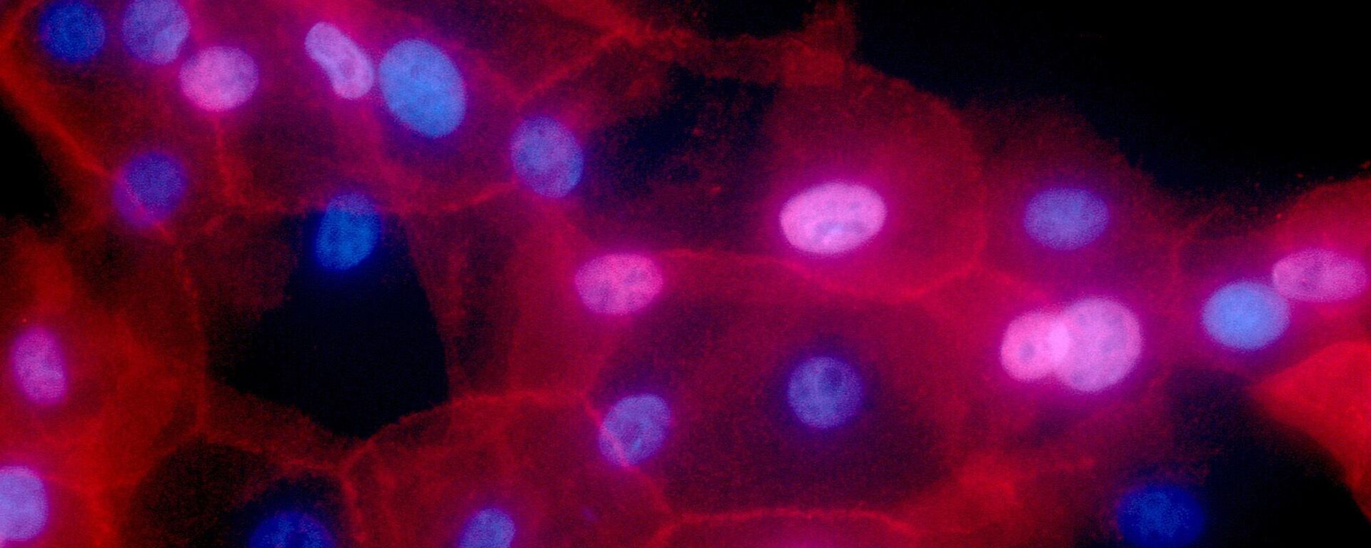 FILE - This undated fluorescence-colored microscope image made available by the National Institutes of Health in September 2016 shows a culture of human breast cancer cells.  - Sputnik India, 1920, 09.02.2024