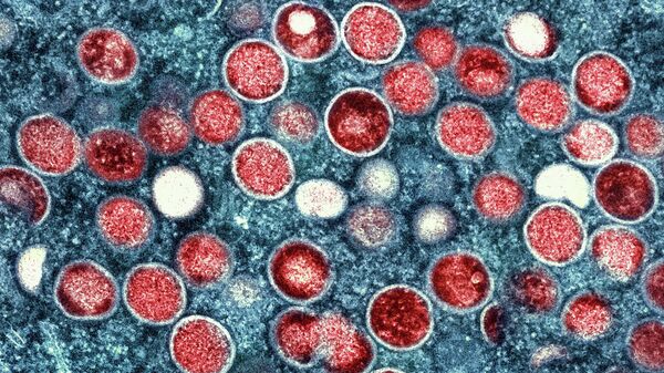   Colorized transmission electron micrograph of monkeypox particles (File) - Sputnik भारत