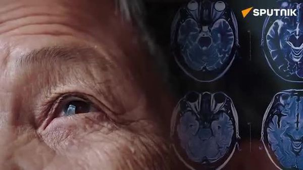 🔥🇷🇺 Russian scientists develop molecule that could help reverse Parkinson's disease - Sputnik India